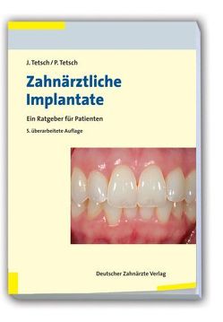 Zahnärztliche Implantate von Tetsch,  Jan, Tetsch,  Peter