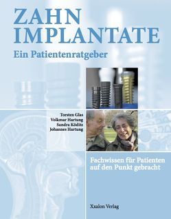 Zahnimplantate – Ein Patientenratgeber von Glas,  Torsten, Hartung,  Johannes, Hartung,  Volkmar, Köditz,  Sandra