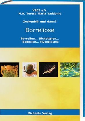 Zeckenbiss und dann? Borreliose von Taddonio,  Theresa