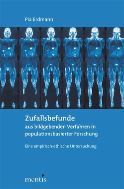 Zufallsbefunde aus bildgebenden Verfahren in populationsbasierter Forschung von Erdmann,  Pia