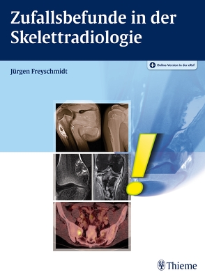 Zufallsbefunde in der Skelettradiologie von Freyschmidt,  Jürgen